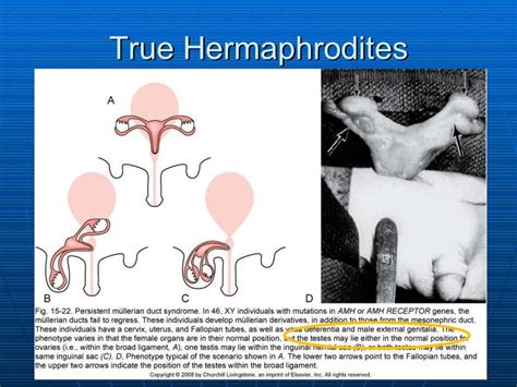 pornhermaphrodite|Hermaphrodite .